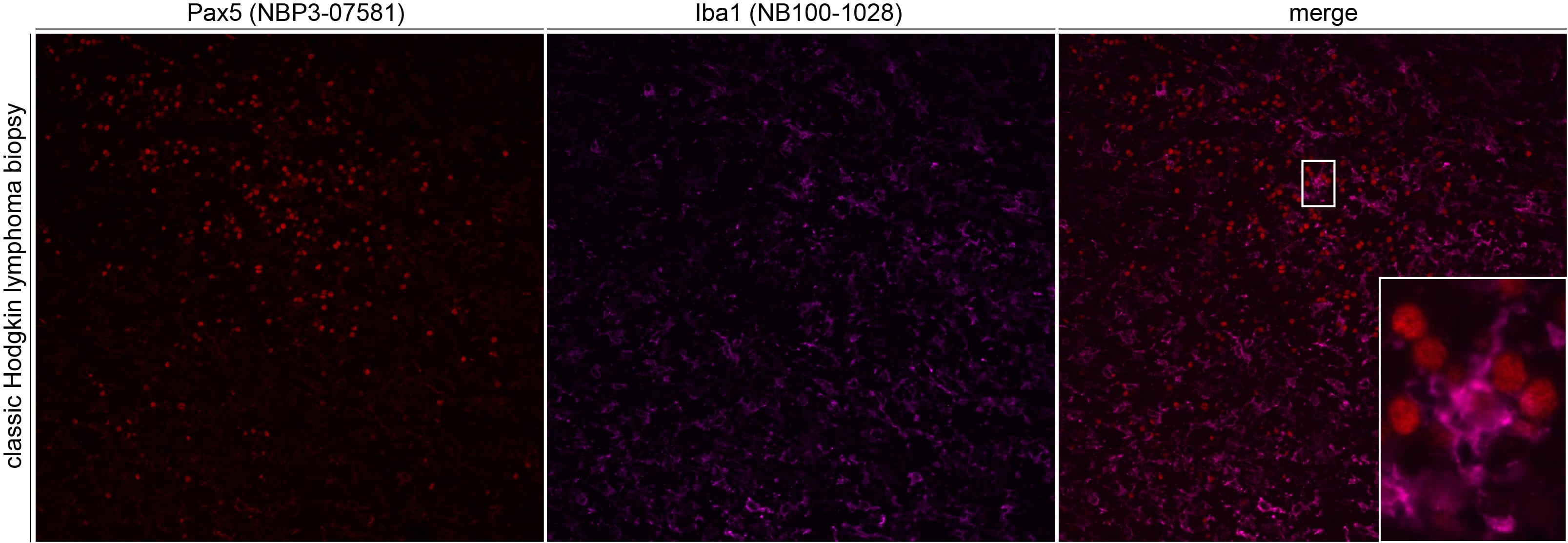 AIF-1/Iba1 Antibody NB100-1028